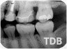 teeth x-ray