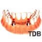 2 dental implants+ 4 unit bridges