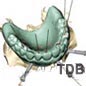 teeth-in-an-hour-computer based planning