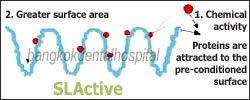 slactive dental implant surface