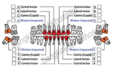 tooth stem cell, teeth stem cells, tooth cell bank, tooth cell banking bangkok Thailand