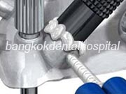 Branemark system Zygoma with NobelGuide Bangkok