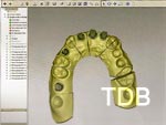 Straumann CADCAM  design abutment shape