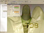 Straumann CADCAM  design abutment shape