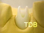 Straumann CADCAM  design abutment shape