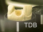 Straumann CADCAM abutment lab procedure