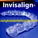 invisalign in dental clinic bangkok and invisalign in dental clinic thailand